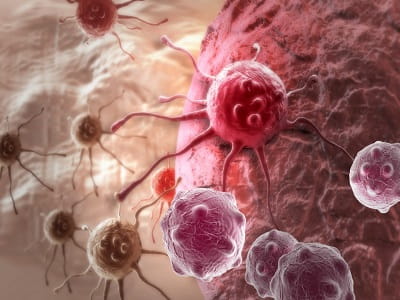Liver Cancer Therapeutics Market - TechSci Research
